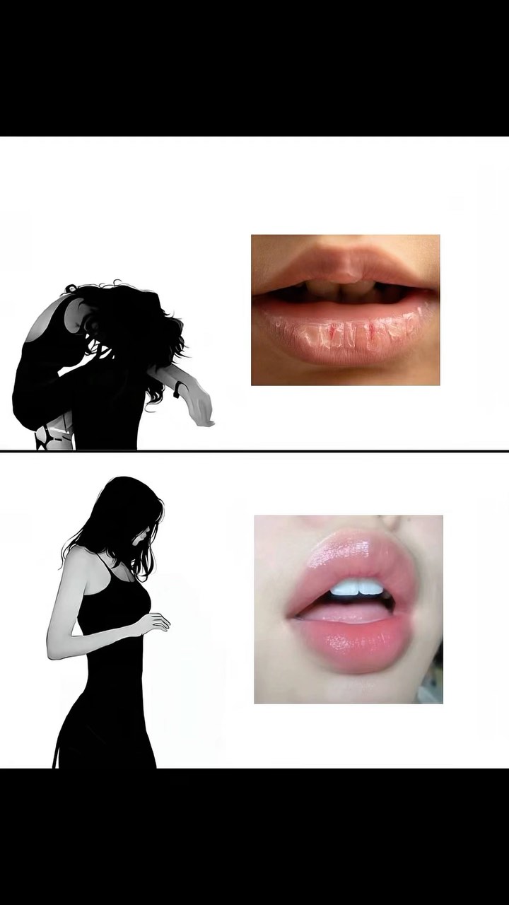 The image is a split composition on a white background, showcasing the contrast between potential lip conditions. In the top section, a close-up of cracked, dry lips is displayed, highlighting an unhealthy state. The bottom section features a sleek, digitally drawn silhouette of a person and a close-up of full, luscious lips with a pink hue, suggesting healthy and attractive lips. The color palette is simple, with the black and white figures starkly contrasting with the natural lip tones.