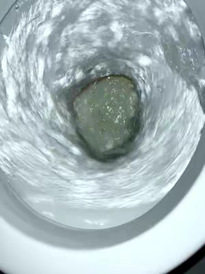 An overhead view inside a toilet bowl. The water is swirling, creating a vortex effect. At the center, a solid, grey mass floats amidst the water.