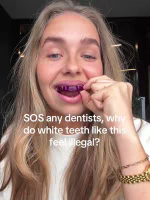 A woman with blonde hair looks directly at the camera, holding a purple teeth whitening tray in her mouth. Text overlayed across the bottom asks a question about why white teeth feel illegal. She wears a white shirt and a gold watch.