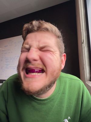 A man with a beard and short, light brown hair is shown with his eyes closed and mouth open wide as if he is screaming. Inside his mouth is a purple object. He is wearing a green sweatshirt, and the background is a blurry office setting with a window.