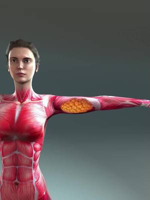 The image is a medical illustration of a human body. It shows a woman with a detailed rendering of muscles and skeletal structure, with a focus on the arm. A highlighted portion on the arm features a detailed view of underlying fat. The background has a gradient from a lighter gray at the top to a darker gray at the bottom.