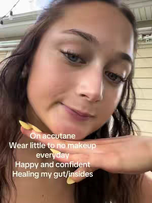 A close-up selfie of a young woman, with her face taking up most of the frame. She has brown hair, blue eyes, and a slight smile. Her left hand is raised to her face, with yellow-painted fingernails. Text overlays are positioned below her face, providing additional context. The background is blurred, but suggests an outdoor setting. The overall composition is casual and inviting.