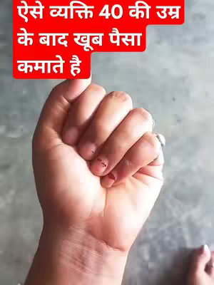 A close-up shot of a hand, possibly a woman's hand, with a red box containing Hindi text in the top left corner. The hand is in a fist with the index finger slightly extended, and there are small, dark polka dots on the knuckles. The skin tone is fair, and the background is a light, neutral color.
