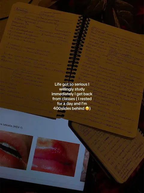 The image shows an open notebook with handwritten notes, a digital tablet displaying images of a lip with a lesion, and a second notebook in the blurred background. The lighting is warm, creating a sense of studying.