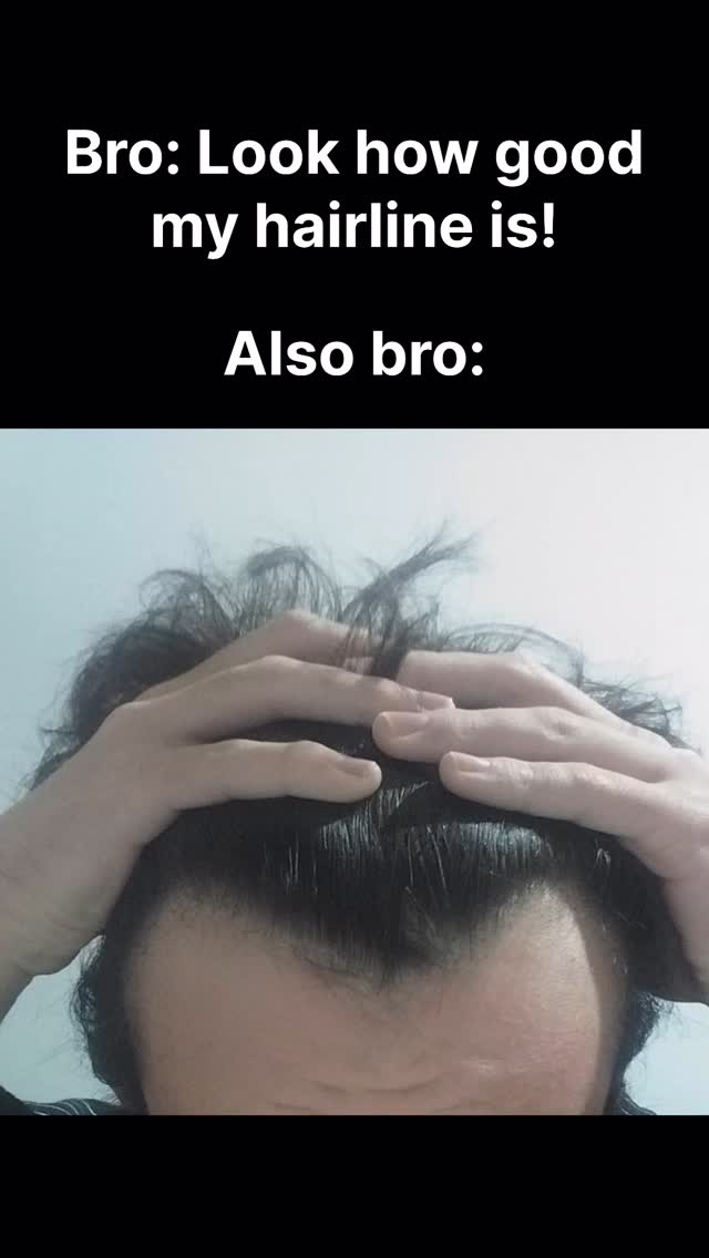 The image is a split-screen composition that humorously contrasts a man's perceived hairline with his actual one. The top portion has overlaid text on a black background, while the bottom shows a close-up of a man's head and receding hairline, as his fingers part his hair, revealing a lack of hair on his forehead, which shows evidence of hair loss at the front.