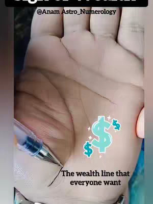 The image features a close-up of a person's palm, with the focus on the lines and details of the hand. Positioned on one of the lines, there is a dollar sign. The background is a soft, warm skin tone, and a pen is placed on the hand, used for illustrative purposes. Text is overlaid on the image, pointing to the dollar sign.