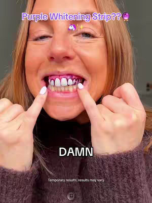 A close-up shot of a woman's face, she's opening her mouth to reveal teeth covered with a purple substance. The top of her face has the text overlayed 'Purple Whitening Strip??', and there's a smaller text that states, 'Temporary results, results may vary' at the bottom. Below her mouth is text that says 'DAMN'. Her hands point toward her teeth.