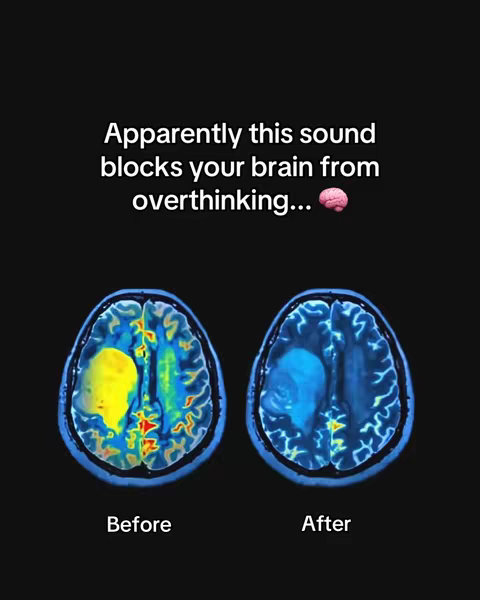 The image is a graphic comparing two brain scans, labeled "Before" and "After." The "Before" scan shows a brain with a large, yellow area, indicating activity, while the "After" scan shows a brain with a blue area, suggesting reduced activity. The text overlay suggests this change is due to a specific sound.