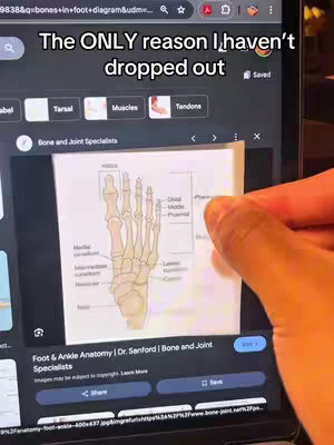 A person's hand is touching a laptop screen that displays an anatomical diagram of a foot. The screen shows a search result from a website called "Bone and Joint Specialists". Overlayed text on the image reads, "The ONLY reason I haven't dropped out".