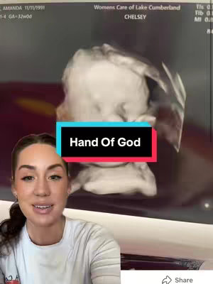 A woman in a white shirt is smiling at the camera. Behind her is an ultrasound image of a baby, partially obscured by the text overlay in the center that reads, 'Hand Of God.' The background shows the top portion of a person's face. The overall composition indicates a blend of personal narrative and medical imagery, suggesting a story about faith or a significant life event.