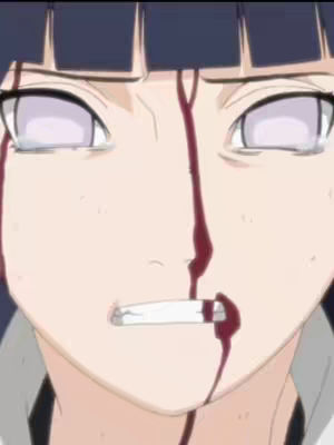 The image is a close-up of a female anime character's face. She has pale skin, large, pale eyes, and dark purple hair with bangs. A prominent feature is blood streaking down her face from her forehead, across her eyes, and down her nose. Her mouth is slightly open, revealing teeth. The overall composition is dramatic, focusing on the character's expression and the visible injury.