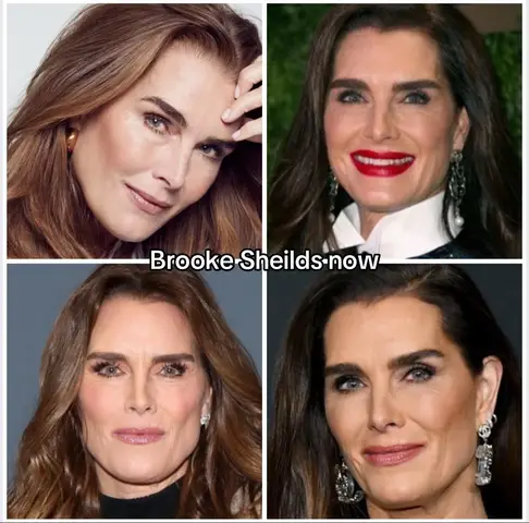 A slideshow with four separate images of Brooke Shields. The top left shows a portrait of her face, the top right shows her with red lipstick, the bottom left shows her in a headshot and the bottom right in a portrait.