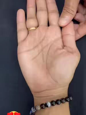 The image shows a close-up of a person's hand, palm facing upwards. The hand is relaxed and open, with visible lines and creases. A gold ring is on the ring finger. A black and white beaded bracelet adorns the wrist, set against a blurry, dark background.
