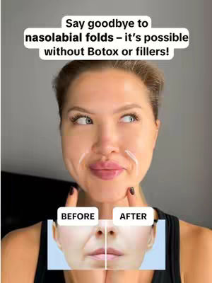 A woman's face is centrally framed with a split image of her own face, comparing 'before' and 'after' views, along with text overlay advertising the benefits of a face yoga app, using the tagline 'Say goodbye to nasolabial folds - it's possible without Botox or fillers!'.