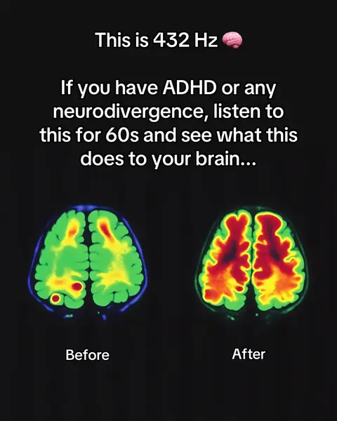 The image showcases a dark background with white text overlayed at the top, stating 'This is 432 Hz.' Below, the text reads 'If you have ADHD or any neurodivergence, listen to this for 60s and see what this does to your brain...'  Two brain scan images are displayed side-by-side, labeled 'Before' and 'After', illustrating a possible transformation effect. One brain scan shows colors concentrated in specific regions, and the other shows the colors spread across the brain indicating a calming result from the 432 Hz sound.