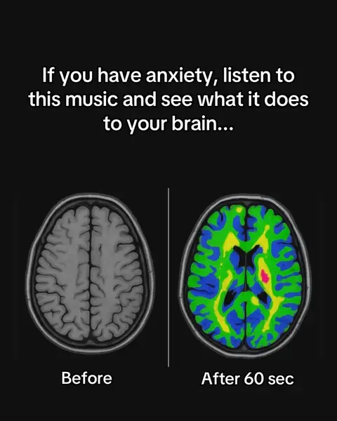 The image is a split-screen comparison: on the left, a grayscale brain scan labeled "Before," and on the right, a color-coded brain scan labeled "After 60 sec." The right scan shows areas highlighted in green, yellow, and pink, suggesting activity changes.