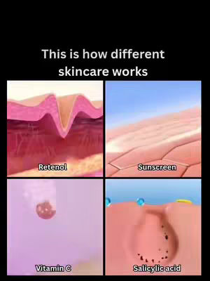 The cover image is a 2x2 grid of images, each representing a different skincare product type and its effect on the skin. The top left shows a close-up of skin with a rough, uneven texture, labeled "Retenol". The upper right quadrant shows a smooth skin surface labeled "Sunscreen". The bottom left displays a small circle, identified as "Vitamin C". The lower right quadrant has an image of skin with a hole and black dots, representing pores and labeled "Salicylic acid". Above this grid in white text is the caption "This is how different skincare works".