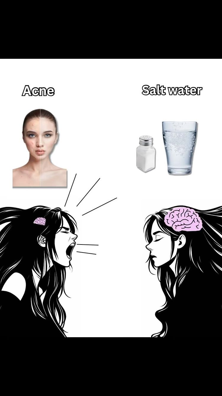 The cover image is a split illustration. On the left, a split image shows a face affected by acne on the left and a clear face on the right. Below, a cartoon woman yells with lines emanating from her head. On the right side, next to a bottle of salt and a glass of water, another cartoon woman has a brain drawn within her head. The image is predominantly black and white with pink details.