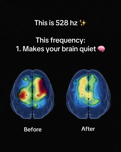 A black background displays white text and a visual comparison of brain activity. Two brain scan images, colored in blues, reds, yellows, and greens, are side-by-side, labeled 'Before' and 'After.' Text at the top says 'This is 528 hz' with a sparkle emoji and 'This frequency: 1. Makes your brain quiet' with a brain emoji next to it.