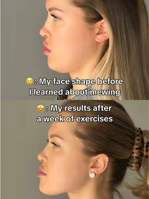 The cover image is a split screen showcasing a side profile of a woman's face. The upper portion features the face before mewing exercises, slightly showing a double chin, while the lower portion displays the face after the exercises; the double chin is less noticeable. Text overlays add context: explaining the 'before' and 'after' states.