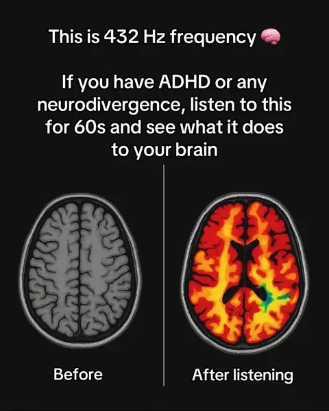 An image comparing two brain scans, labeled 'Before' and 'After listening.' The before scan is gray, while the after shows a colorful scan highlighting brain activity.