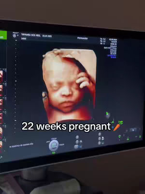 An ultrasound image displayed on a monitor shows a close-up of a fetus, appearing in shades of brown and tan. The fetus's face is visible and is in 3D format, appearing to be in the womb. Below the image, the text overlay reads: “22 weeks pregnant”.