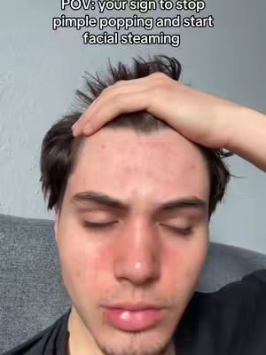 The cover image features a close-up of a young man's face. His eyes are closed, and his right hand is resting on his forehead. The skin on his face appears to be somewhat red. The background is a light gray, and the lighting suggests indoor conditions. Above the man's forehead, white text reads, "POV: your sign to stop pimple popping and start facial steaming".