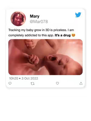 The image is a screenshot from a social media post, likely a tweet. The primary visual element is an ultrasound image of a foetus, appearing in a reddish-pink hue. The foetus is positioned in the center, with its face and hands visible. Above the ultrasound, there is a profile picture of a person with a caption identifying them as 'Mary' with the username '@Mar078', and a timestamp. The layout is simple, with the text and image arranged to highlight the emotional impact of the 3D ultrasound.