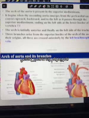 The image shows a screenshot of a document displayed on a screen. It consists of written text, diagrams, and the Arabic text overlayed. The background suggests a digital interface that is likely a note or drawing application with various tools available.