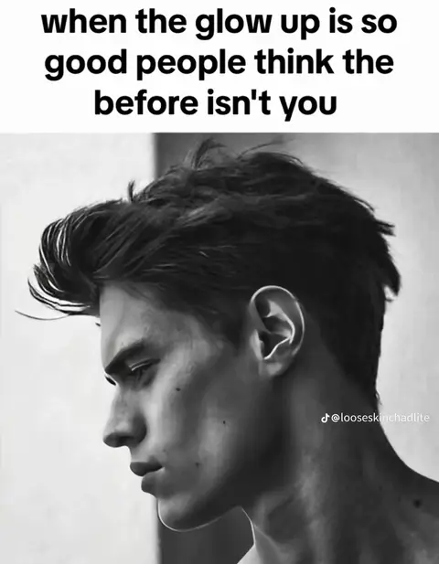 A black and white image featuring a man in profile, looking down and to the side. He has short, styled hair. Text overlayed at the top reads: 'when the glow up is so good people think the before isn't you' Other text overlayed at the bottom right states a username.