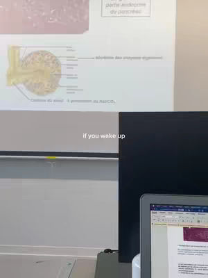 A vertical shot with a projection screen and a computer screen. The projection screen shows what appears to be a biological diagram. The computer screen on the right shows a document open. In the foreground is a laptop open on a desk. Text overlay says 'if you wake up'.