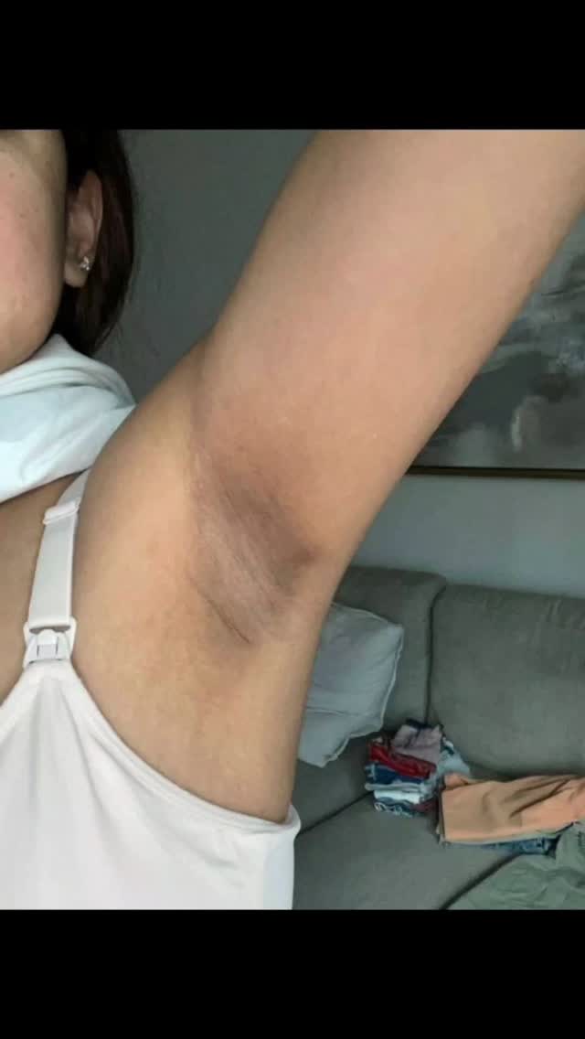 The image shows a close-up of a woman's armpit with visible shadowing, potentially highlighting the results of a skincare routine. The skin tone is light.