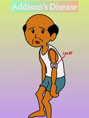 An illustrated image featuring a cartoon figure with the text "Addison's Disease" at the top. The figure is a person with dark hair and an elderly appearance, wearing a white tank top and blue shorts. An IV-like element is attached to the figures arm, with the text "Low BP" near it. The background fades from a light purple to a lighter shade.