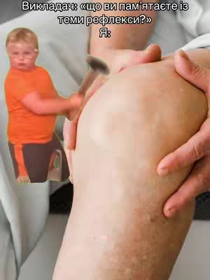 The cover image is a humorous meme. It shows a child-like figure with glasses holding a mallet, superimposed on a close-up of a knee. Text at the top reads, "Викладач: «що ви пам'ятаєте із теми рефлекси?» Я:" (Teacher: "What do you remember about reflexes?" Me:). The composition is a joke visualising the answer using the classic medical reflex hammer.