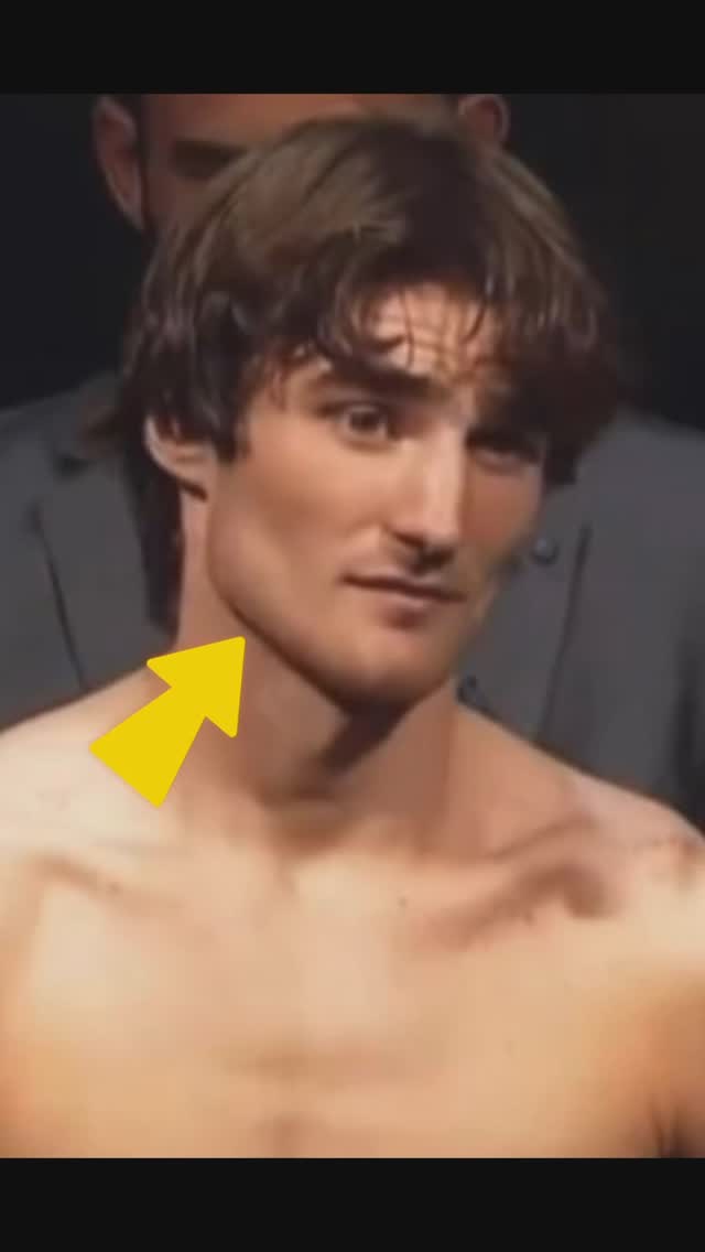 The cover image shows a close-up of a man's face, highlighting his jawline. A yellow arrow points towards his jaw, drawing attention to the facial feature. He has short, brown hair and is facing the camera, appearing to be in a professional context.