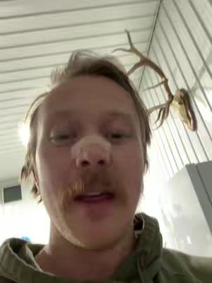 A close-up shot of a man's face, facing the camera, with a bandage on his nose. He has light-colored hair, a mustache, and is wearing a green hoodie. Behing him, there is a white, slatted ceiling, and a wall with a deer antler mount.
