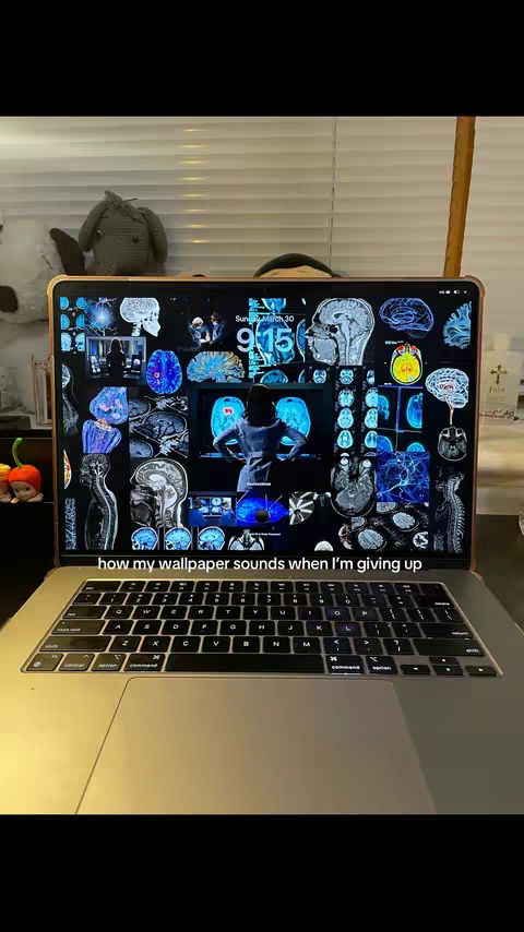 A laptop displaying a custom wallpaper featuring brain scans, anatomical diagrams, and a person, with the keyboard visible in the foreground and a cluttered background.