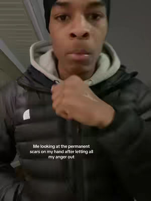 A young man is shown from the chest up in a dimly lit environment. He's dressed in a black beanie, a gray hooded sweatshirt, and a black puffer jacket. His right hand is raised, with his fist gently touching his chin. Text overlayed on the image reads, "Me looking at the permanent scars on my hand after letting all my anger out".