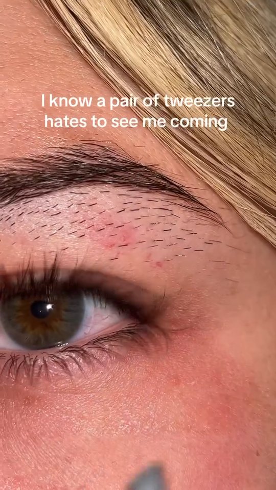 A close-up shot of a face, focusing on the eye and eyebrow. The skin appears to be light-toned with visible pores and some redness. The eyebrow is dark and well-defined, with individual hairs visible, some of which have been plucked. Above the eye is a text overlay in white font. The eye itself has a green iris, and the eyelashes are visible. The skin around the eye shows some makeup application and a slightly flushed appearance.