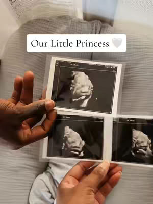 An overhead shot shows a person holding ultrasound images of a fetus. The images are in clear plastic protectors, and the person's hands are visible, along with some of their clothing and the surface the images rest on. A text overlay at the top says: Our Little Princess.