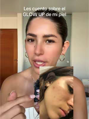 The cover image shows a woman in a selfie-style video. She is facing the camera with a concerned expression, pointing towards a smaller image overlay of another woman’s face showing skin with blemishes. The background is neutral, with a door on the right side.