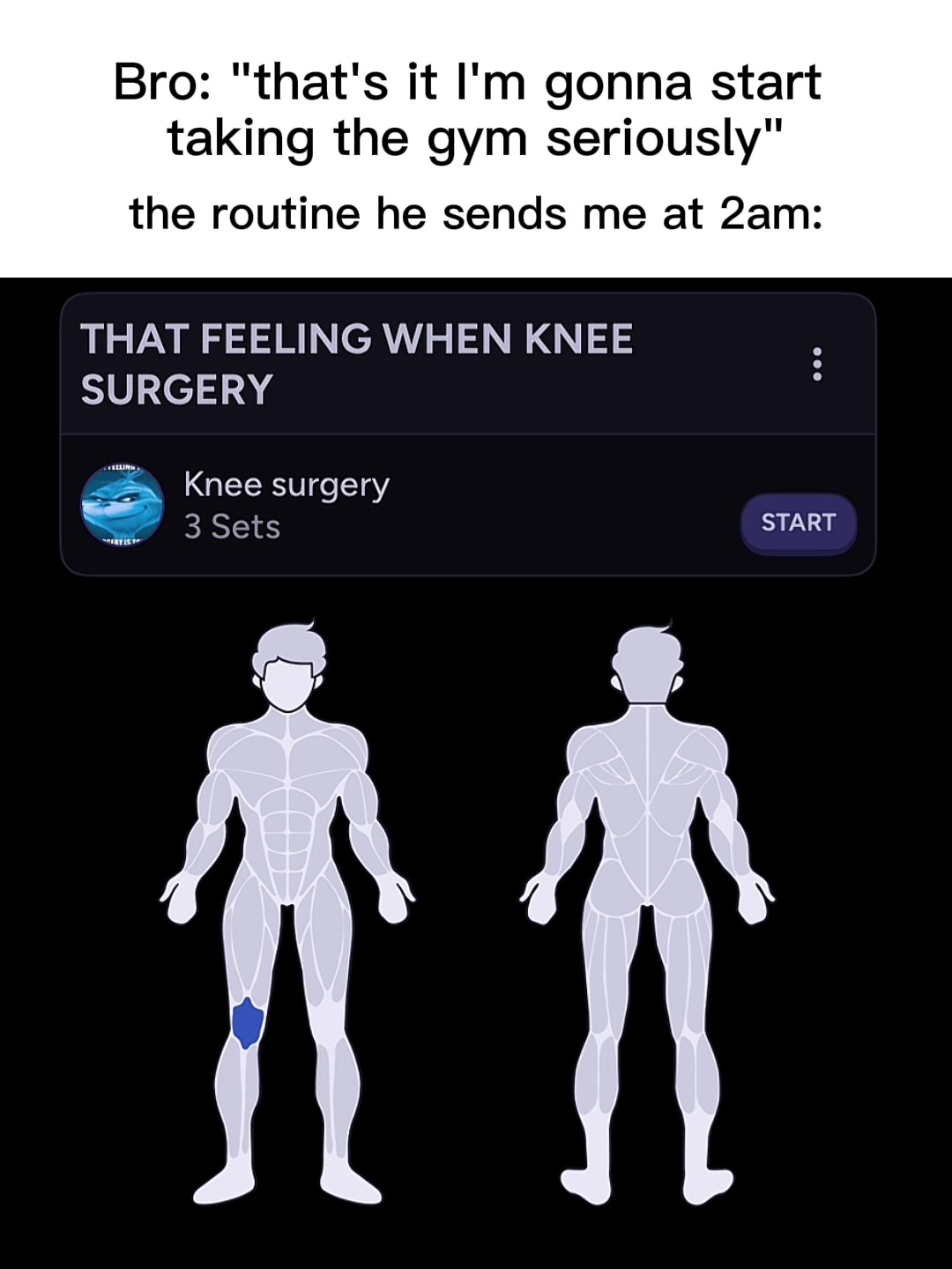 The image is a meme-style graphic. At the top, white text against a black background reads: "Bro: "that's it I'm gonna start taking the gym seriously" the routine he sends me at 2am:" Below that, a dark blue box displays text suggesting a workout app interface. It has the words "THAT FEELING WHEN KNEE SURGERY" at the top, followed by "Knee surgery" and "3 Sets". Next to it is a "START" button, all in white text. Below,  silhouette illustrations of two human figures, one facing forward, one facing backward. A blue shape highlights the knee area on the forward-facing figure.