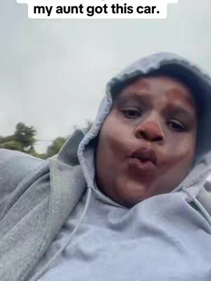 A selfie-style image features a person in a gray hoodie with the hood up and the face filling the frame. The individual has a slightly puckered expression and a light complexion with a visible red nose. The background is a blurred mix of sky and possibly other outdoor elements. Overlay text at the top of the frame that reads "my aunt got this car."