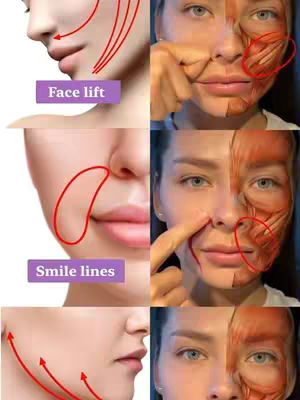 A split image showing a woman's face with illustrations of face yoga techniques. The left side features a close-up profile with red lines indicating areas to target for a face lift and smile lines, and the right side shows a woman's face with a diagram of facial muscles.