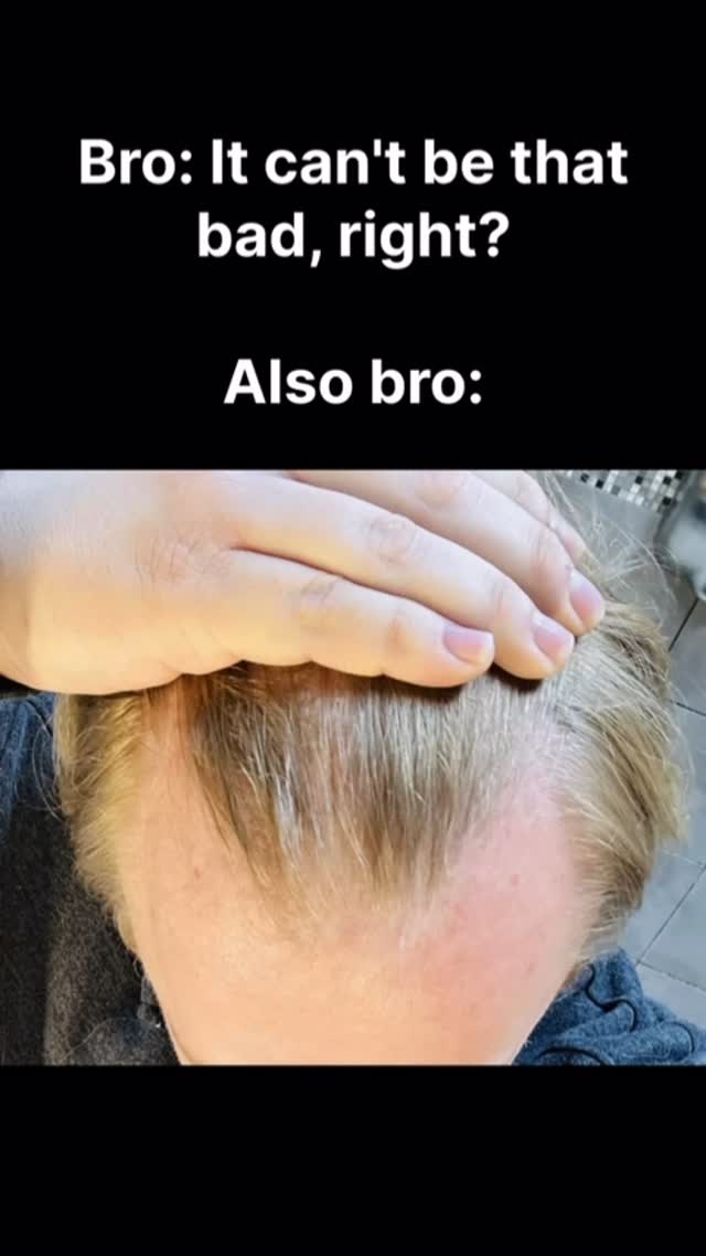 The image shows a person's scalp with thinning hair, with the hand on top. There is text overlayed.