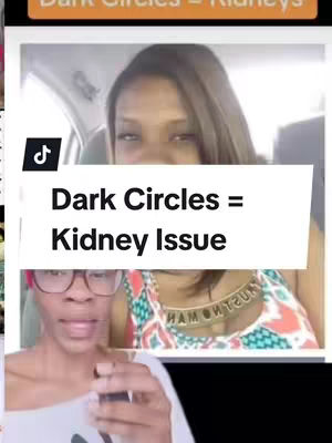 The image is a vertical collage. At the bottom is a woman with glasses looking at something off-screen, with a light background. Above her is a woman from the chest up, with a patterned top and a necklace, in the background. On the center, a title "Dark Circles = Kidney Issue" in a white rectangle covers the faces.