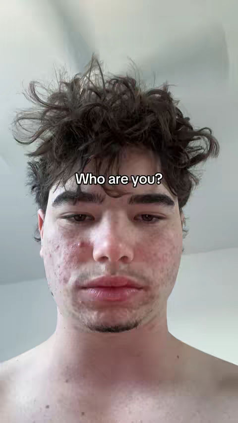 A selfie-style shot of a young man from the chest up. The man has short, unkempt dark hair. He has visible acne and redness on his face. He is looking down with a neutral expression. Above the man's head is the hook text, 'Who are you?'. The background is a plain, off-white wall.