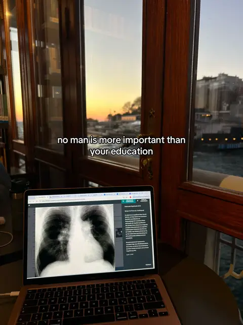 A laptop displaying an X-ray image is placed on a table in front of a large window. The window frames a scenic outdoor view, featuring a sunset with orange and yellow hues and a cityscape silhouette. The laptop is open, showing the X-ray image prominently. The text overlay reads, "no man is more important than your education".
