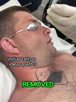 The cover image shows a man lying down, angled from his chest up. He has safety eyewear on. The text overlay, in a sans-serif typeface, reads initial tattoo, ideas part 3. Below in a larger green font it says removed. Behind him is a cream color.