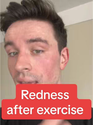 A close-up shot of a man's face. His skin is a mix of natural tones and patches of redness across his cheeks and nose. Below him is a red banner with the text 'Redness after exercise' in white, bold letters.